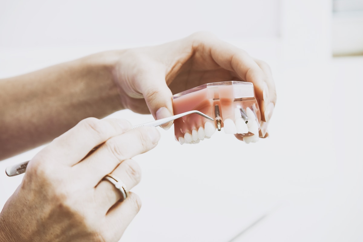 State-of-the-art dental implant centre at Supreme Elite Clinic Kelambakkam